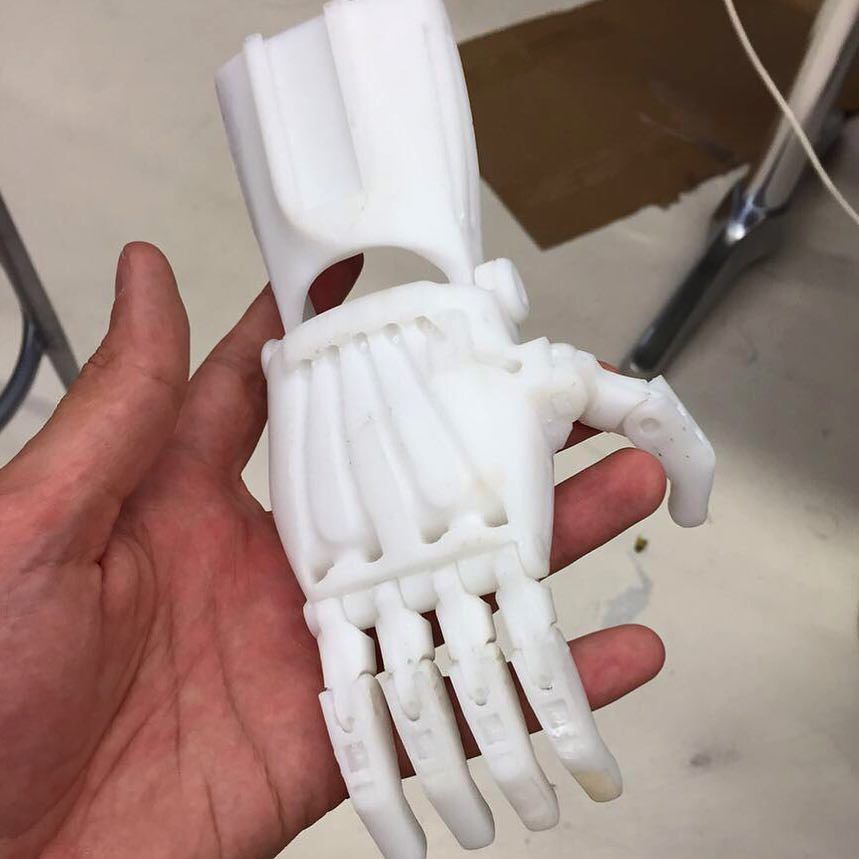 biyonik el