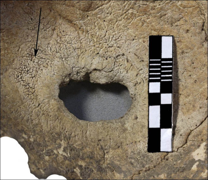 inside_newly_formed_bone_1