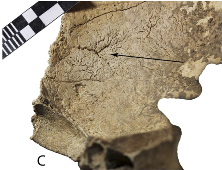 inside_newly_formed_bone_2