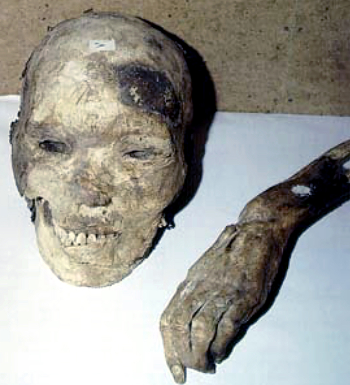 Hun warrior mummy