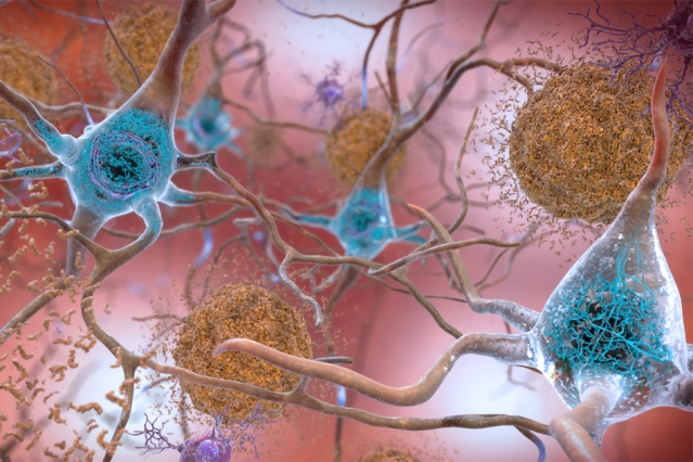 MIT-Alzheimers-Genes-01_0