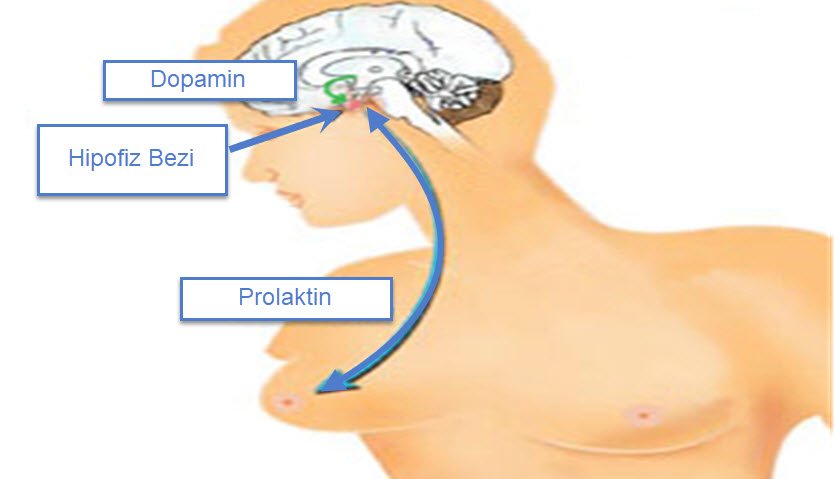 hiperprolaktinemi-nedir